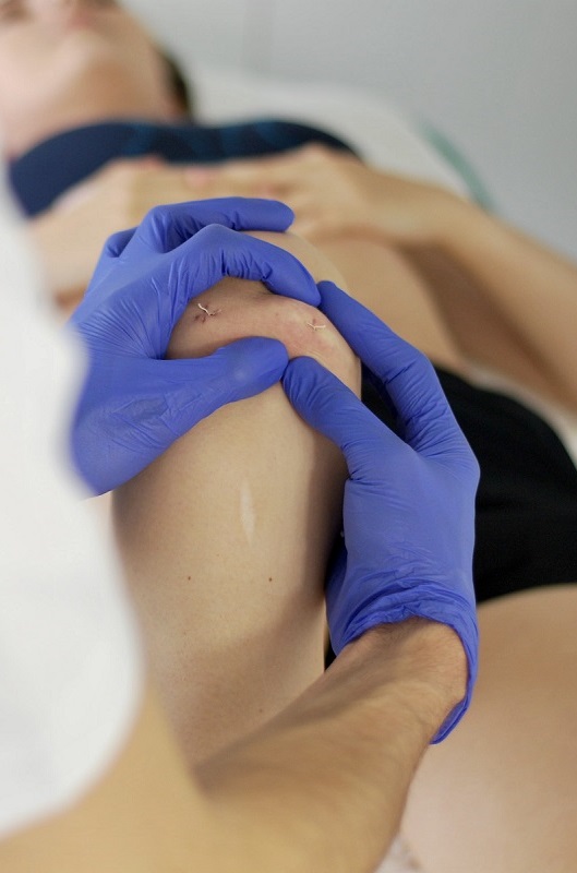 rehabilitacja pooperacyjna u fizjoterapeuty